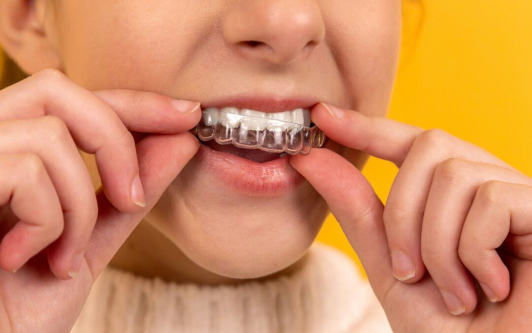 Simply Clear Braces for Kids: A Parent’s Guide